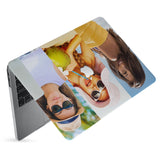 hardshell case with Photo Collage design has matte finish resists scratches