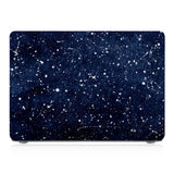 Macbook Case - Positive Quote - Beautiful Dreamer